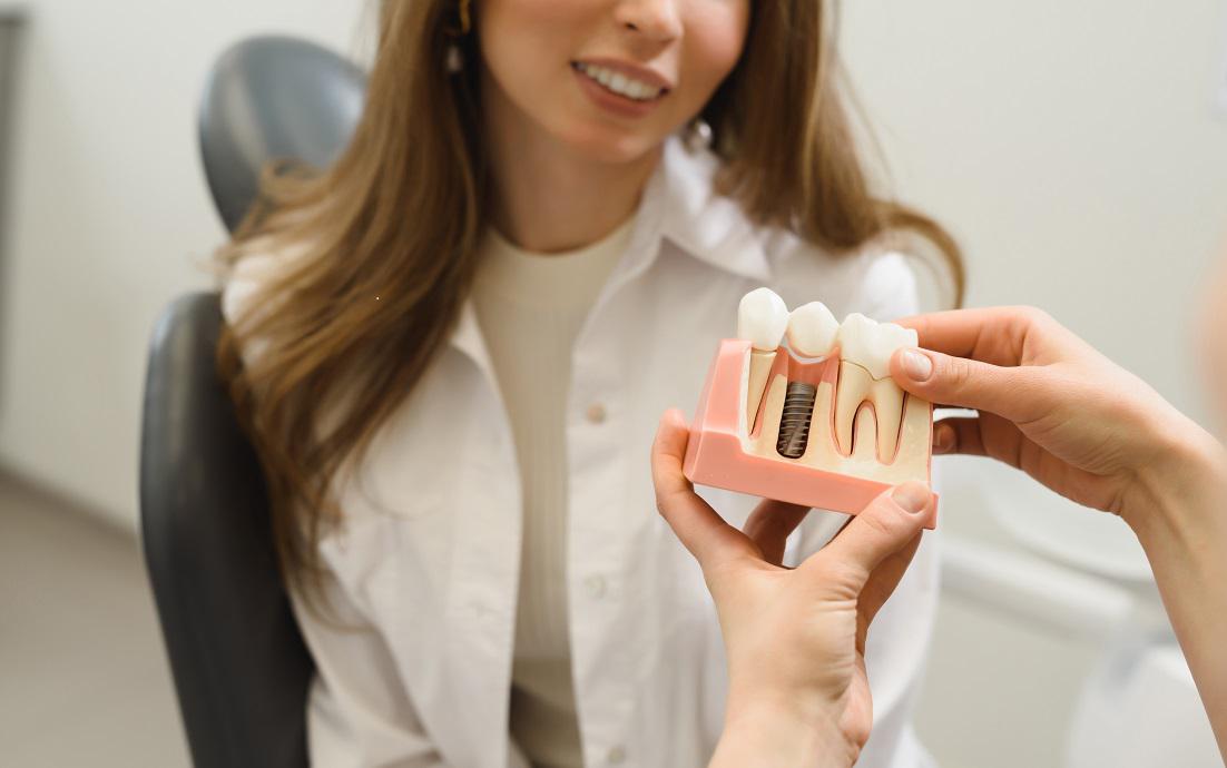 Three Reasons to Consider Dental Implants